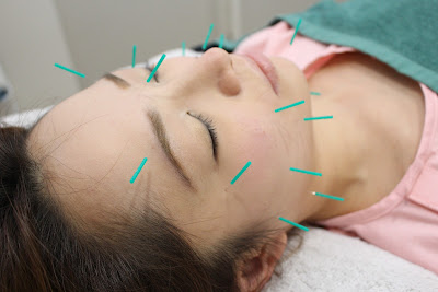鍼灸マッサージ Private Salon B-HariT 六本木店 사진 4