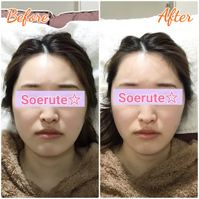 Soerute 사진 4