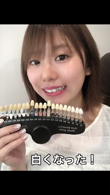 Rise Beauty Salon（ホワイトニング・LED脱毛・光フォトフェイシャル・痩身・ララピール） 사진 2