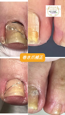 Nail&Eyelash ／ドクターネイル爪革命＋CURE用賀店(プラスキュア） 사진 3
