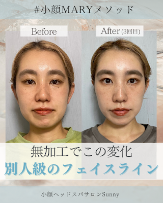 小顔サロン Sunny 学芸大学 사진 4