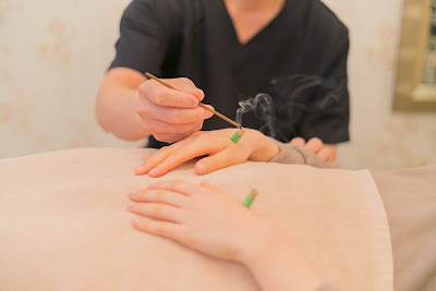 Asumoharikyu Acupuncture 사진 3