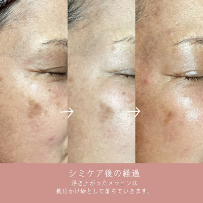 Skin salon de MORRICONE 사진 3