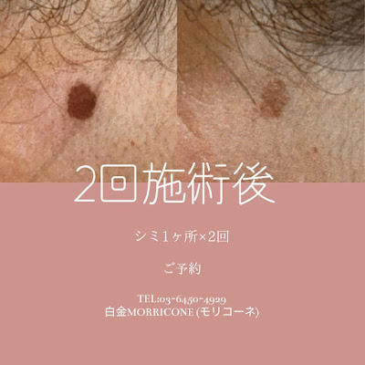 Skin salon de MORRICONE 사진 4