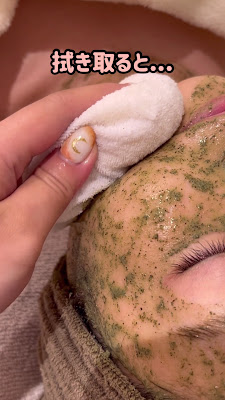 【小顔矯正/ハーブピーリング/毛穴洗浄】Beautysalon Ulu下北沢 사진 2