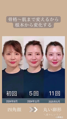 小顔矯正・プロセル・骨格矯正・美肌・育毛サロンOlino（オリノ） 사진 2