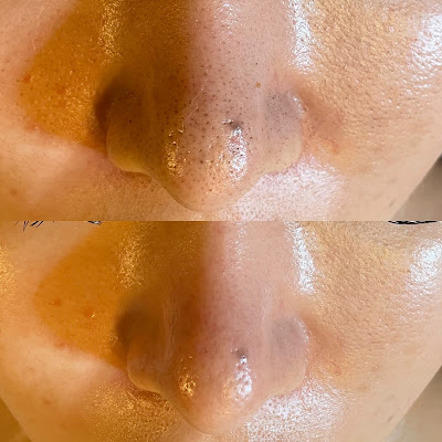English-Speaking Facial Salon: Mocci Beauty Tokyo 사진 4