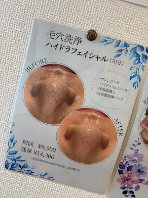 ～肌質改善・毛穴洗浄・ピーリング・脱毛～Amour 【アムール】新宿・四谷三丁目店 사진 5