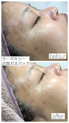 cémo~セモ~eyebrow&facial wax 사진 3