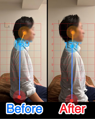 ポジティブ鍼灸整体｜笑う門 新小岩店 사진 5