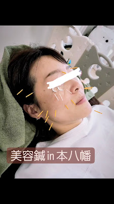 鍼灸サロンLUCA 사진 3