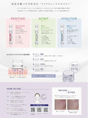 uni. 사진 5