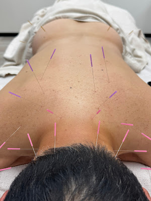 Athliv. sportsmassage tokyo ginza 사진 4