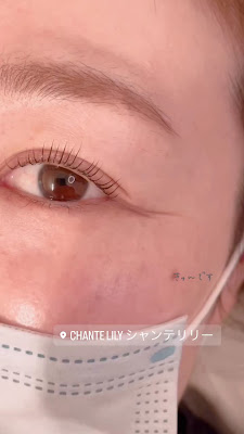 Chante Lily 사진 2