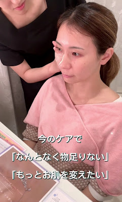 Dione 사진 2