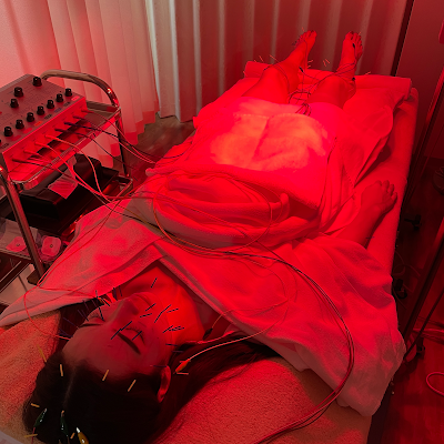 Hide Acupuncture 사진 5