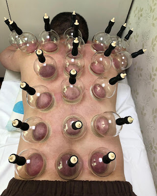 米ぬか100%酵素風呂 梅 사진 5