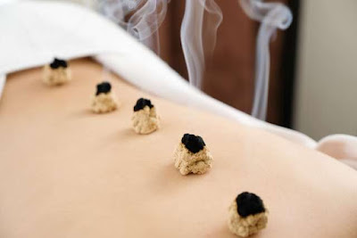Oriental Acupuncture 사진 2