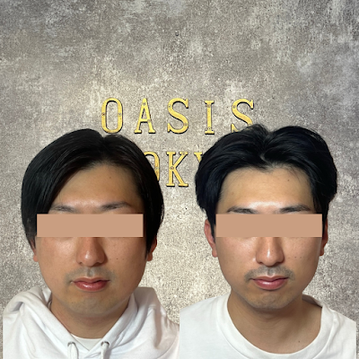NEO OASIS TOKYO 川崎店〜小顔矯正・美容鍼・脱毛・ハーブピーリング・痩身〜 사진 3
