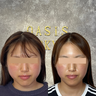 NEO OASIS TOKYO 川崎店〜小顔矯正・美容鍼・脱毛・ハーブピーリング・痩身〜 사진 2
