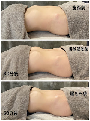 腸とリンパの専門サロンPOBO 사진 3