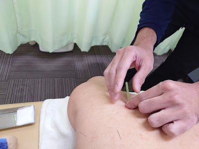 Yotsubashinkyu Acupuncture 사진 4