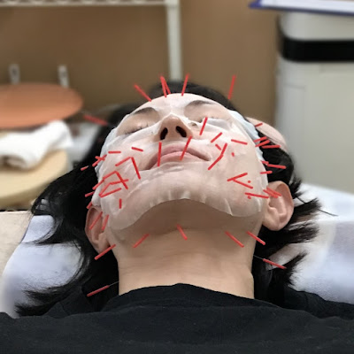 M . A . K . Shinkyu Acupuncture 사진 4