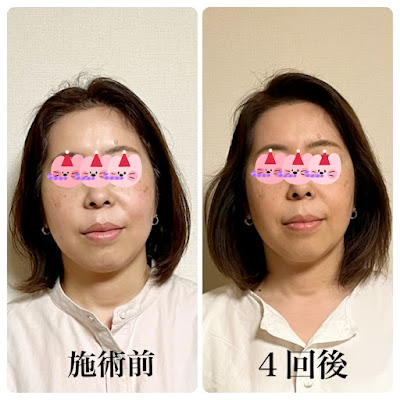 美容鍼灸治療院 リネア 武蔵小杉 사진 4