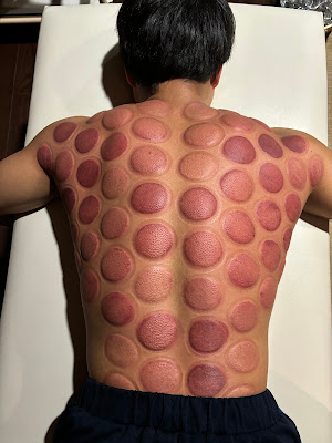 Nagomi Acupuncture Orthopedic Clinic 사진 4