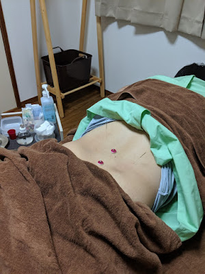Hatano Acupuncture 사진 2