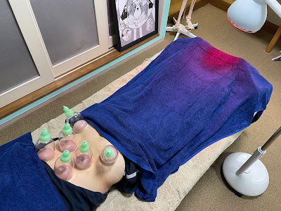 ReVIVE Shinkyu Massage Clinic 사진 3
