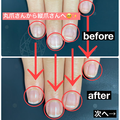Ohana nail 사진 4
