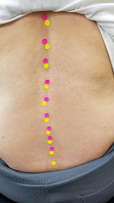 Asahi Orthopedic Clinic 사진 3