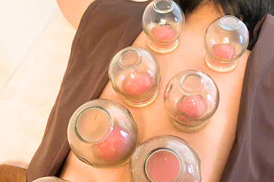 Okusawauru Acupuncture 사진 4