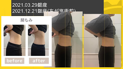 腸元氣堂YimYim中延店 사진 5