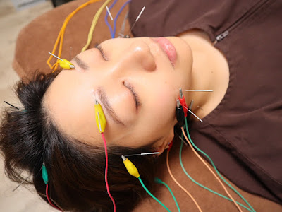Yasu Acupuncture 사진 3