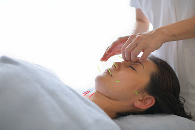Natural Biyo Aratabiyo Acupuncture 사진 5
