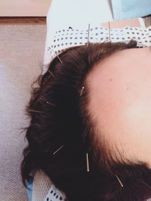 Hikarishinkyu Acupuncture 사진 5