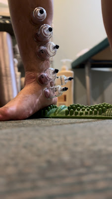 Nagomi Acupuncture Orthopedic Clinic 사진 4