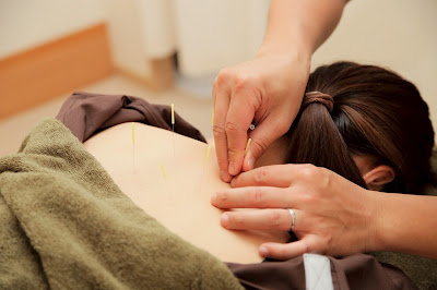 Ishihara Acupuncture Orthopedic Clinic 사진 5