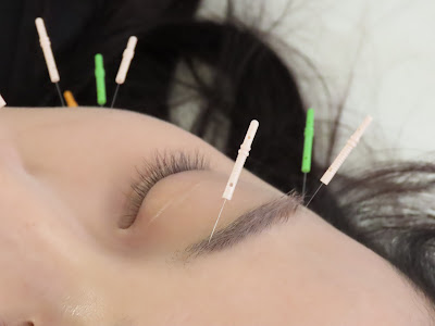 Saigashinkyu Acupuncture 사진 3