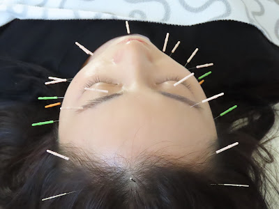 Saigashinkyu Acupuncture 사진 4