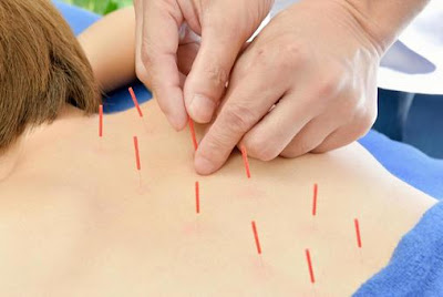 武蔵小山マッサージ鍼灸整骨院/Musashi-koyama Massage Acupuncture Moxibustion Judo-therapy Center 사진 4