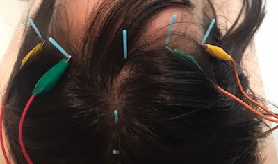 Motohashiseikotsu Acupuncture 사진 2