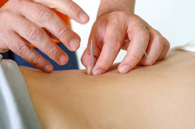 Nagi Nine Acupuncture 사진 5
