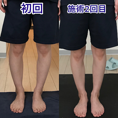 VCL 足首姿勢改善ラボ 사진 5