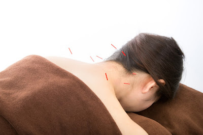 おりえ鍼灸治療院 Olie Acupuncture & Moxibustion 사진 2