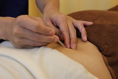 Kasai Acupuncture 사진 2