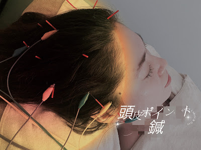TIARABO 小顔美容鍼 사진 3