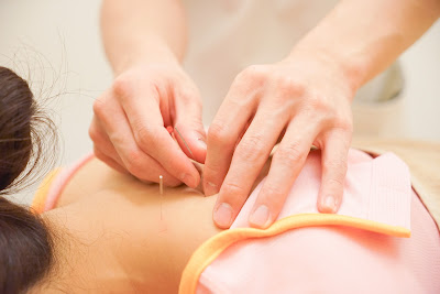 Harri Up Cerulean Tower | Acupuncture 사진 3